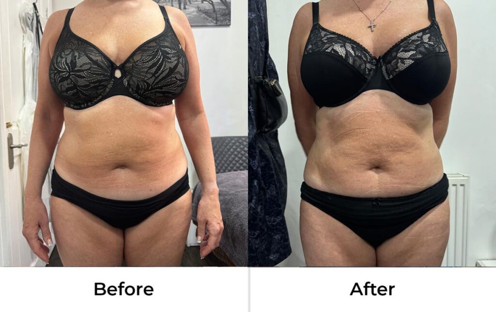 BeforeAndAfter01.jpg