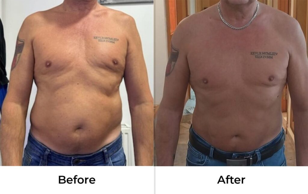 BeforeAndAfter2.jpg