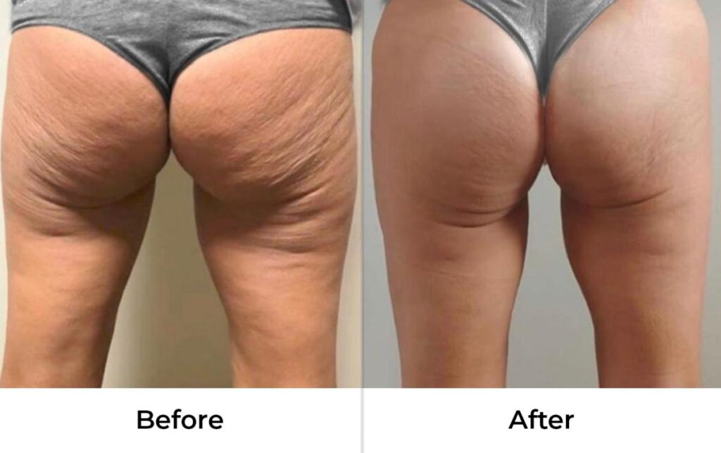 BeforeAndAfter3.jpg